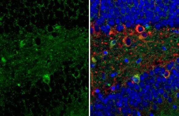 P2Y2 Antibody (HL2801)