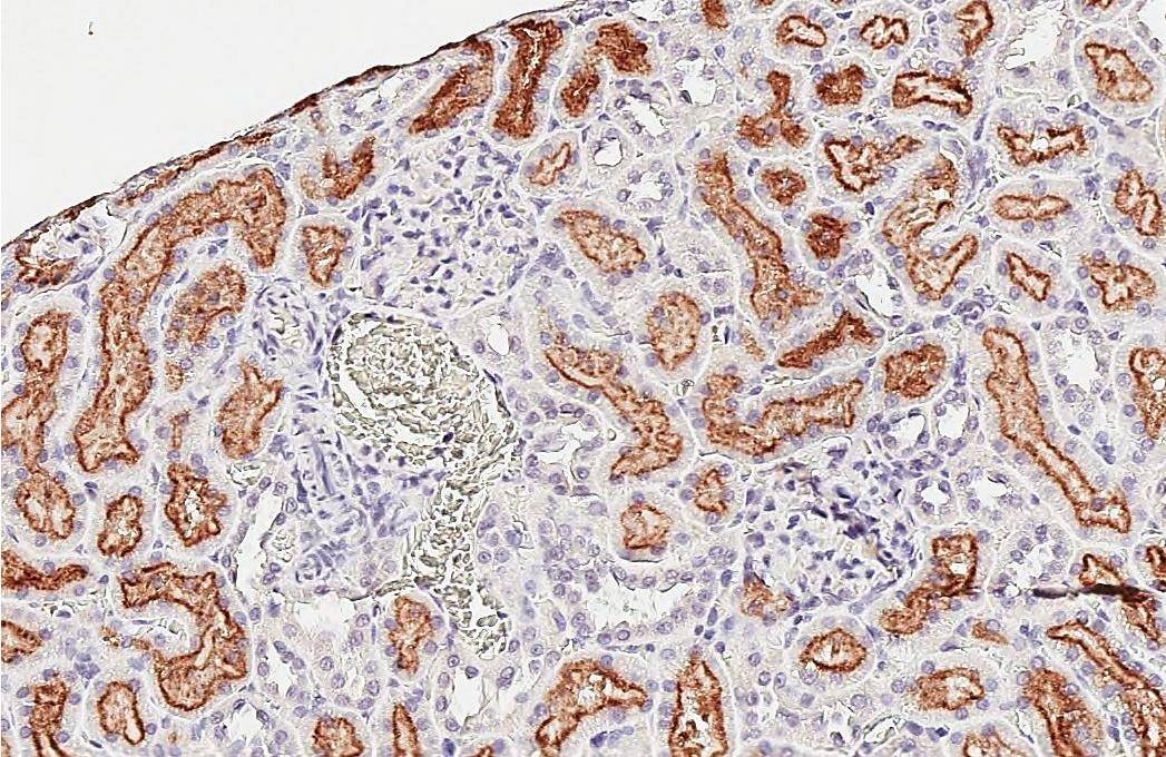 P2Y2 Antibody (HL2801)