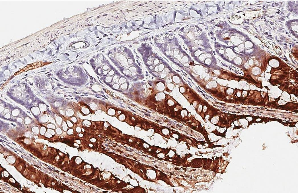 P2Y2 Antibody (HL2801)