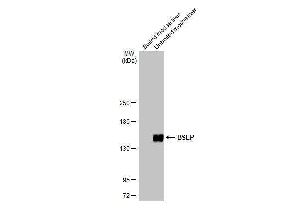 ABCB11 Antibody (HL2803)