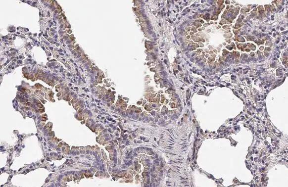 EDNRB/Endothelin R Type B Antibody (HL2832)