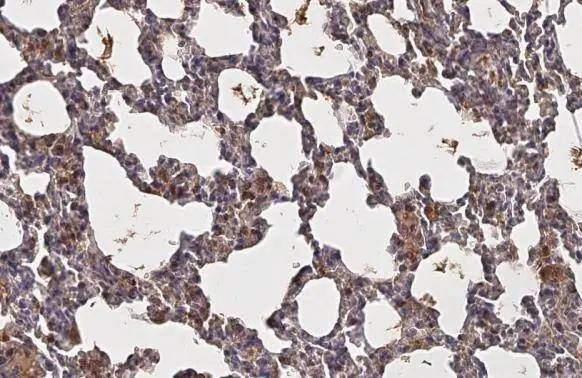 EDNRB/Endothelin R Type B Antibody (HL2832)