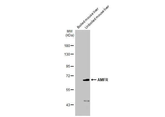 AMFR/gp78 Antibody (HL2865)