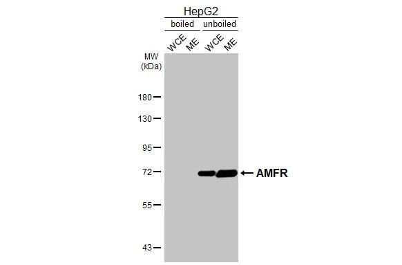 AMFR/gp78 Antibody (HL2865)