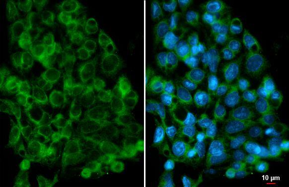 AMFR/gp78 Antibody (HL2866)