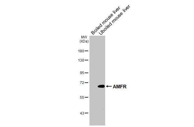 AMFR/gp78 Antibody (HL2866)