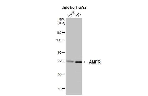AMFR/gp78 Antibody (HL2866)