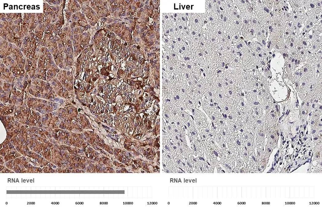 Elastase Antibody (HL2882)