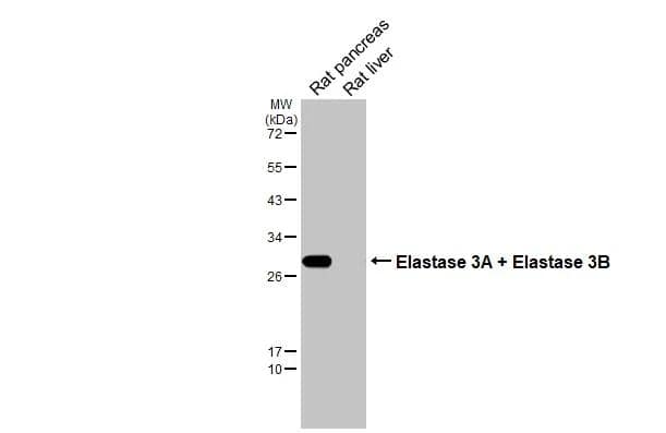 Elastase Antibody (HL2882)