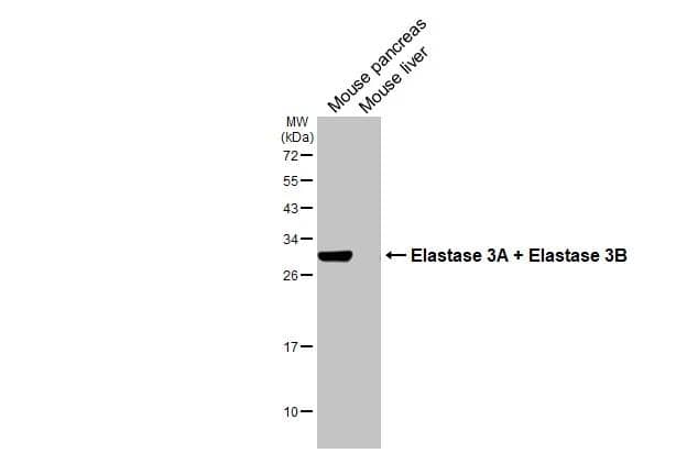 Elastase Antibody (HL2882)