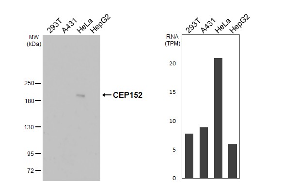CEP152 Antibody (HL2884)