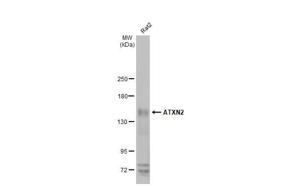 Ataxin-2 Antibody (HL2885)