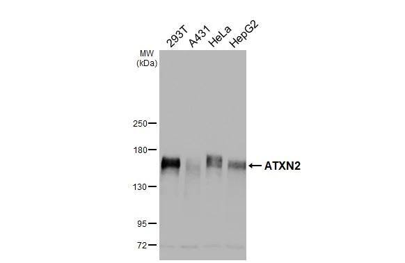 Ataxin-2 Antibody (HL2885)