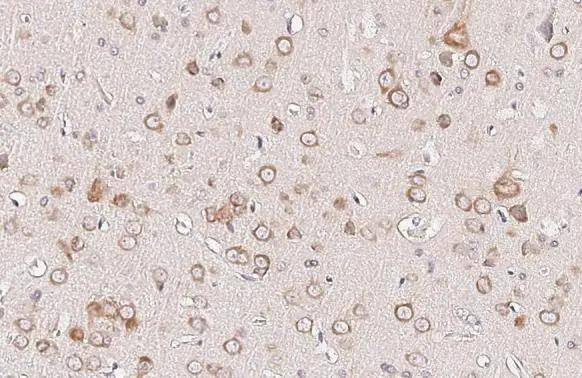 Ataxin-2 Antibody (HL2886)