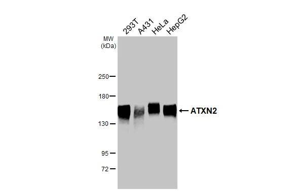 Ataxin-2 Antibody (HL2886)