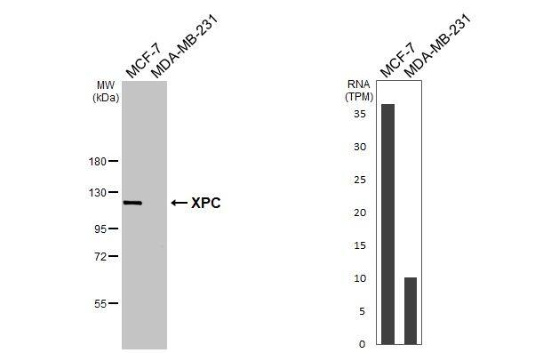 XPC Antibody (HL2894)