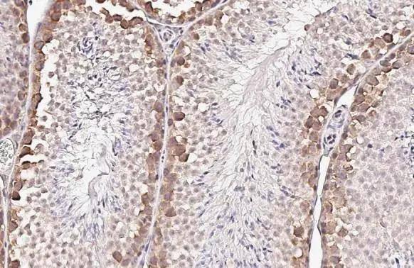 YTHDF2 Antibody (HL2910)