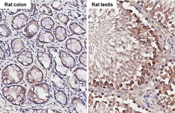 YTHDF2 Antibody (HL2910)