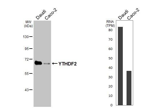 YTHDF2 Antibody (HL2910)