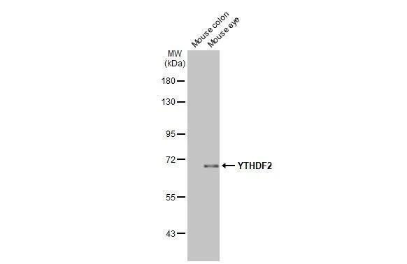 YTHDF2 Antibody (HL2910)