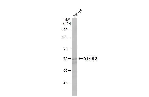 YTHDF2 Antibody (HL2910)