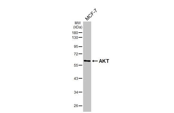 AKT Antibody (HL2915)