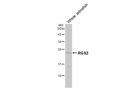 RGS2 Antibody (HL2987)
