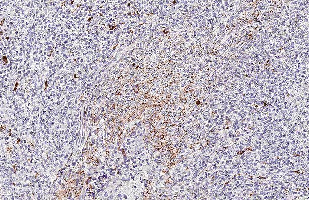 RGS2 Antibody (HL2988)
