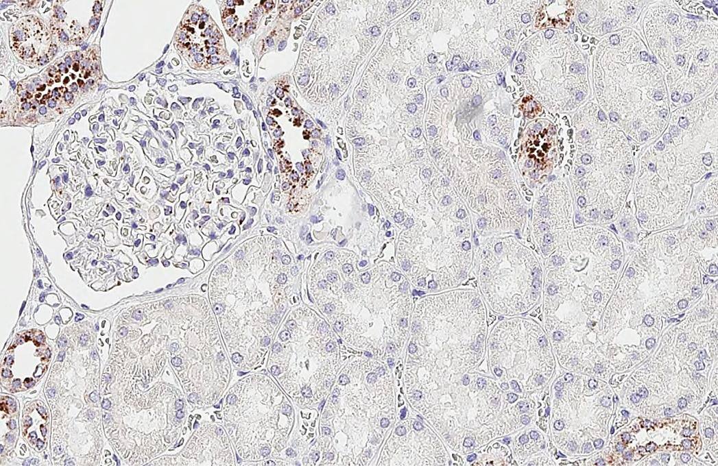 RGS2 Antibody (HL2988)