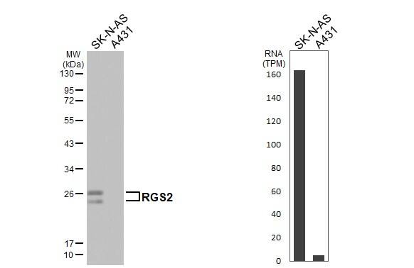 RGS2 Antibody (HL2988)