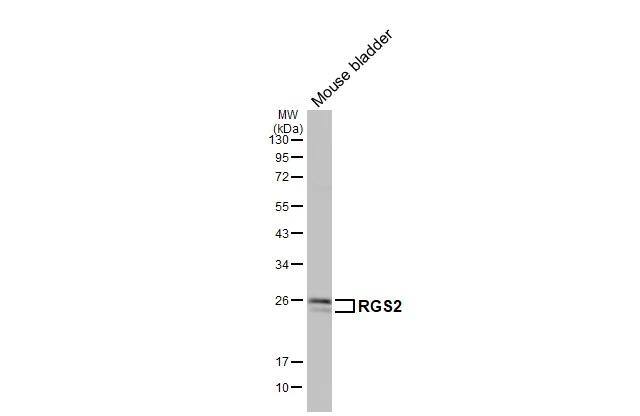 RGS2 Antibody (HL2988)