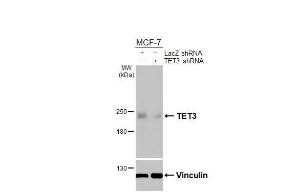 TET3 Antibody (HL3009)