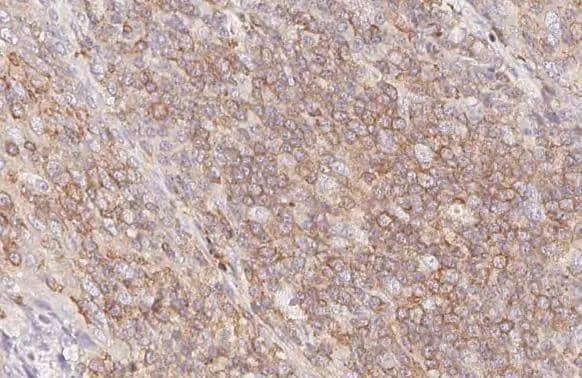 ARL13B Antibody (HL3092)