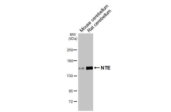 PNPLA6 Antibody (HL3127)