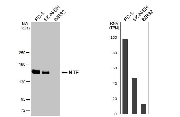 PNPLA6 Antibody (HL3127)