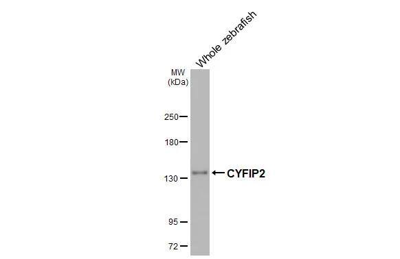 CYFIP2 Antibody (HL3148)