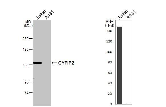 CYFIP2 Antibody (HL3148)