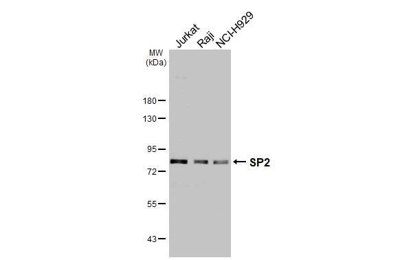 SP2 Antibody (HL3155)