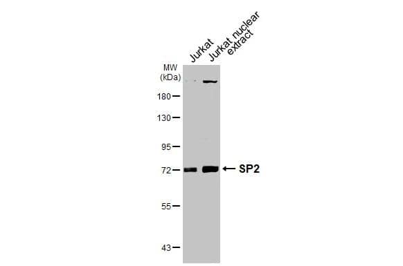 SP2 Antibody (HL3155)
