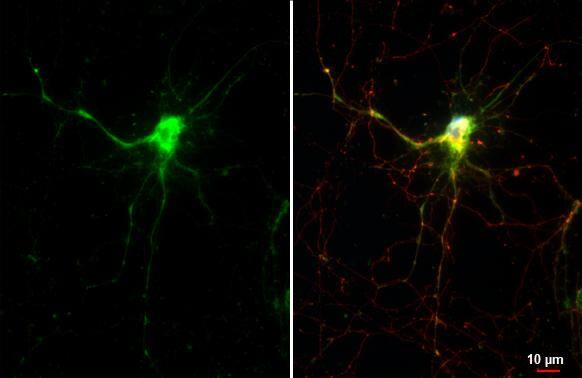 Maxi Potassium channel alpha Antibody (HL3164)