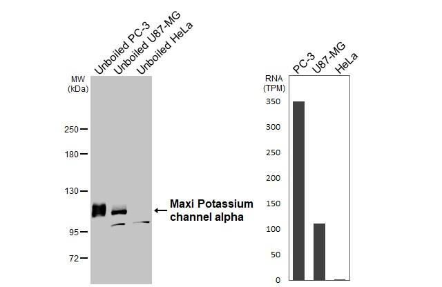 Maxi Potassium channel alpha Antibody (HL3164)