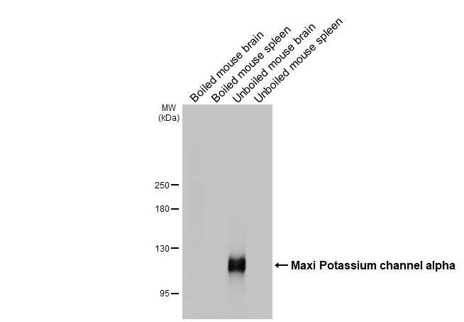 Maxi Potassium channel alpha Antibody (HL3164)