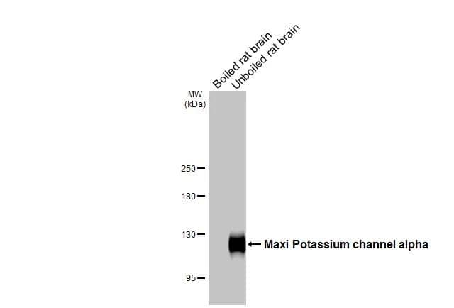 Maxi Potassium channel alpha Antibody (HL3164)