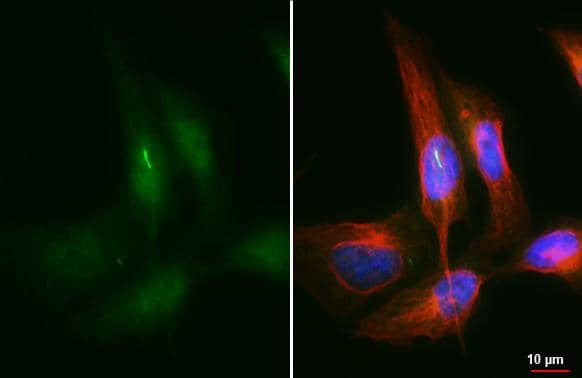 ARL13B Antibody (HL3179)