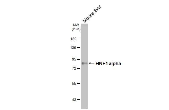 HNF1 Antibody (HL3229)