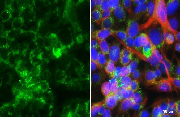 Seladin 1 Antibody (HL3253)
