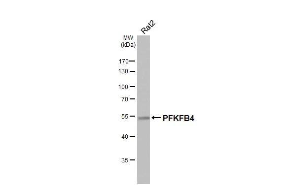 PFKFB4 Antibody (HL3254)