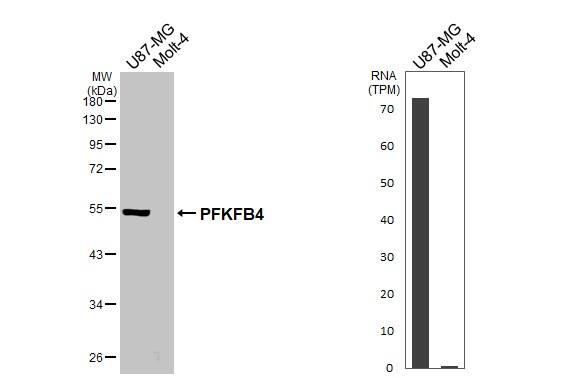 PFKFB4 Antibody (HL3254)