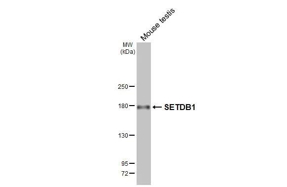 SETDB1 Antibody (HL3259)