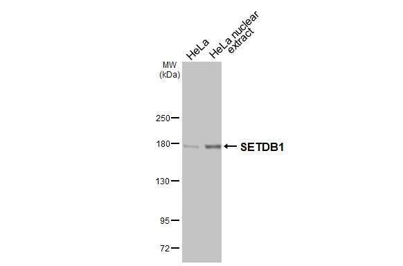 SETDB1 Antibody (HL3259)